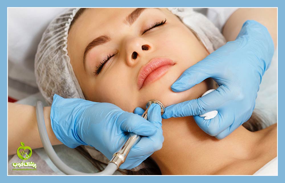 microdermabrasion میکرودرم