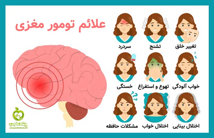 علائم تومور مغزی