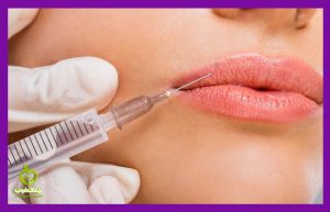 Peels, fillers, grafts